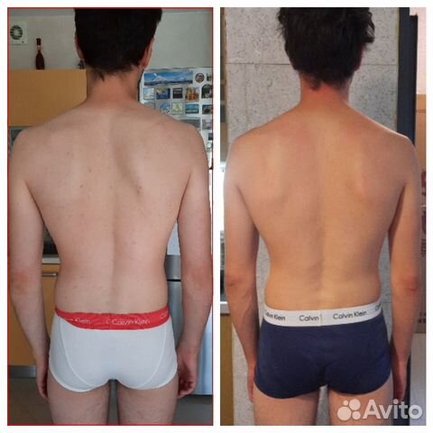 Массаж. Кинезиолог. Кинезиомассаж. Тейпирование